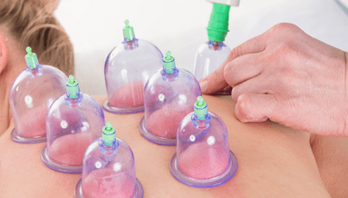 Image for Myofascial Cupping Massage